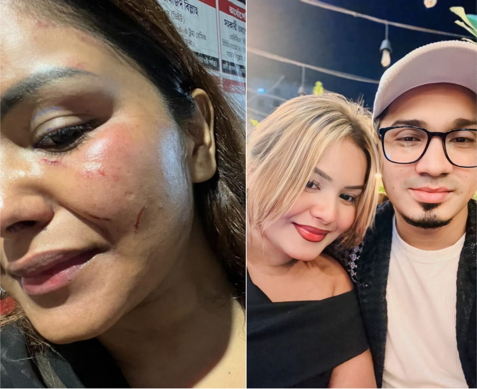 বনানীতে প্রেমিকা নিগ্রহ ও ব্ল্যাকমেইল: নেপথ্যে সিসা ব্যবসায়ী জুয়েল